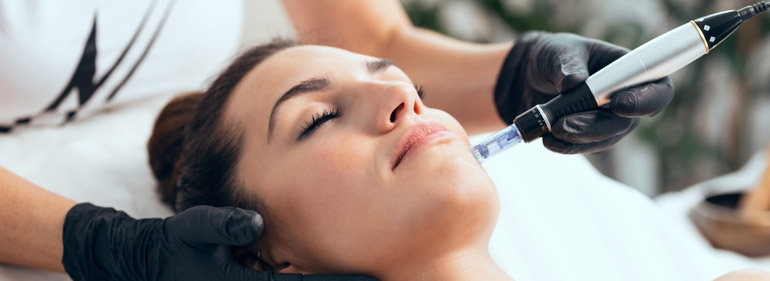 Microneedling in Clermont FL at Anahiz Aesthetics MedSpa