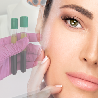 PRP with Facial