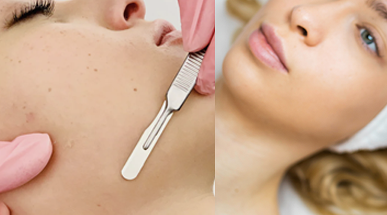 Best place of true splander