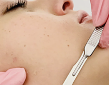 Dermaplaning and deep cleansing facial in Clermont near Legends Pointe