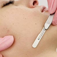 Dermaplaning