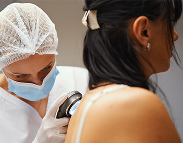 tattoo removal treatment clermont